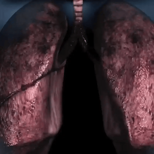 جهاز الأصلي لتقوية الرئة والتنفس 🫁 – Respiratory Trainer - TROPYMALL