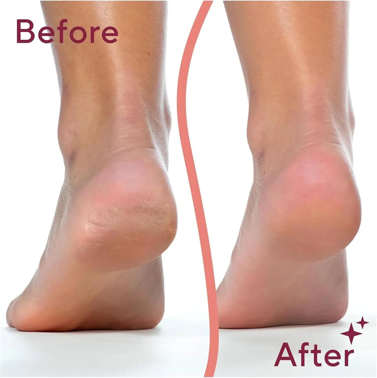Râpeuse Pieds Electrique جهاز كهربائي يزيل الجلد الميت وتشققات الكعب