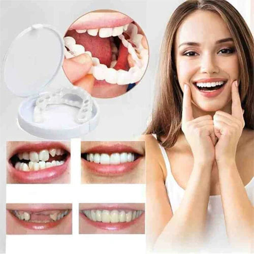 إبتسامة هوليود سمايل ✨